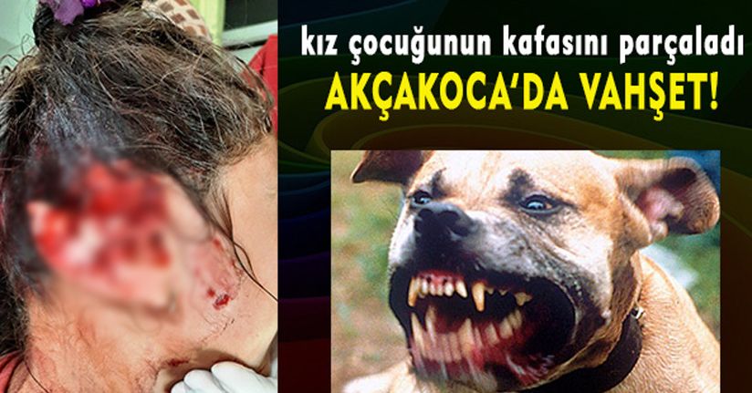 Akçakoca’da Pitbull Vahşeti!.. Kız Çocuğunun Kafasını Parçaladı