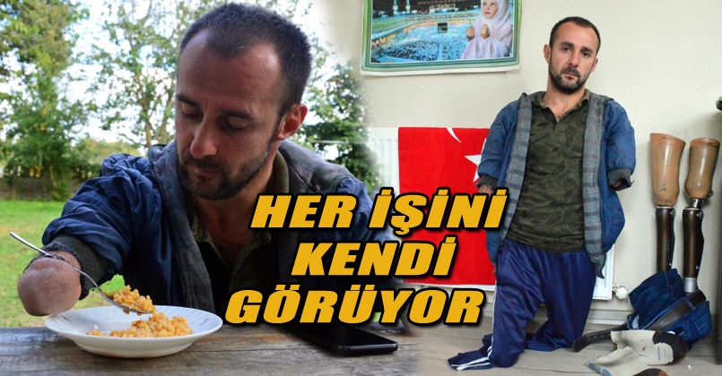 Doğuştan engeli ona ‘engel’ olamadı