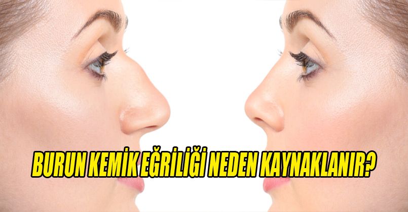 Burun Kemik E rili i Neden Kaynaklan r Sa l k Haberleri D zce Tv